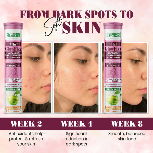 GlowFizz - 600mg Japanese Glutathione Effervescent Tablets